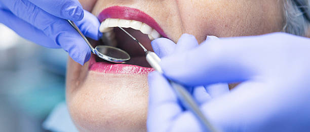 Best Emergency Wisdom Teeth Removal in Mdleton, ID